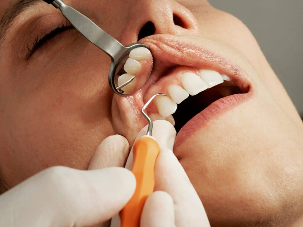 come i disturbi alimentari influenzano i denti e la salute orale